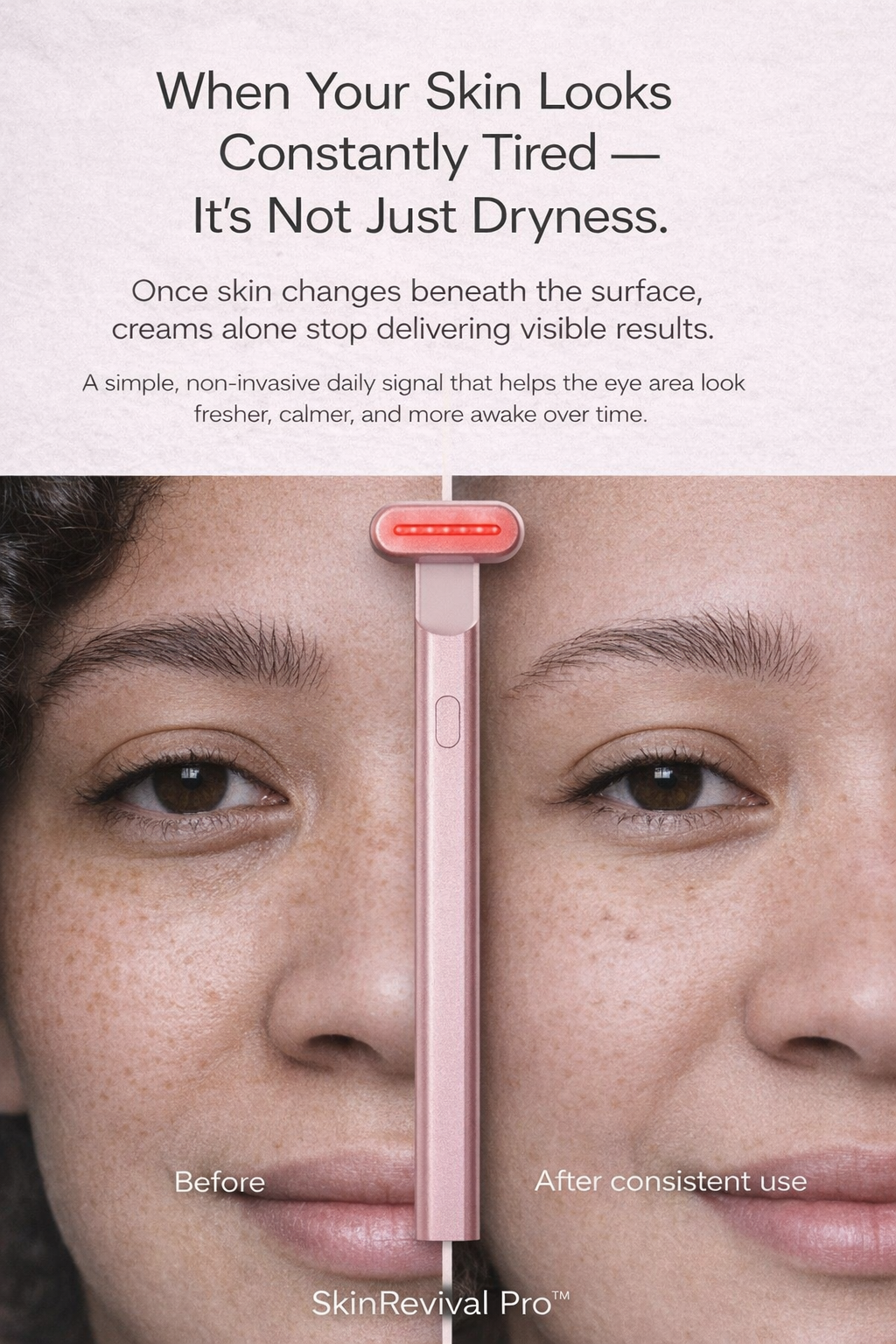 SkinRevival Pro™ 4-in-1 Skincare Wand with Red Light Therapy